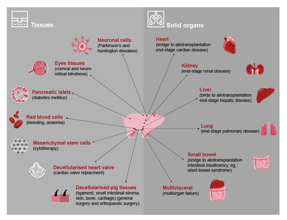 Disorders for which xenotransplantation is a potential therapy